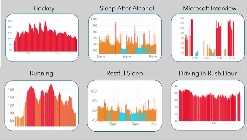 ECG On Apple Watch 4