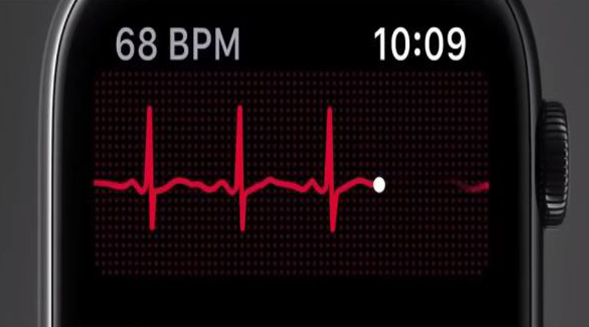How The ECG On Apple Watch 4 Works? | superfashion.us