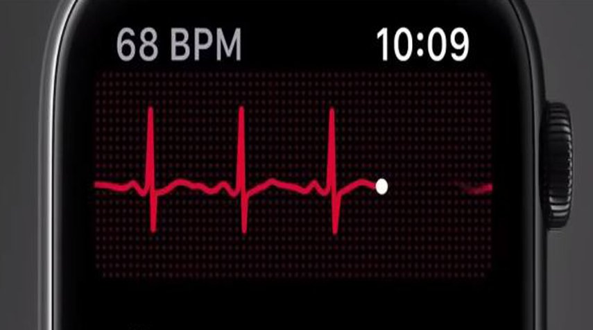 ECG On Apple Watch 4